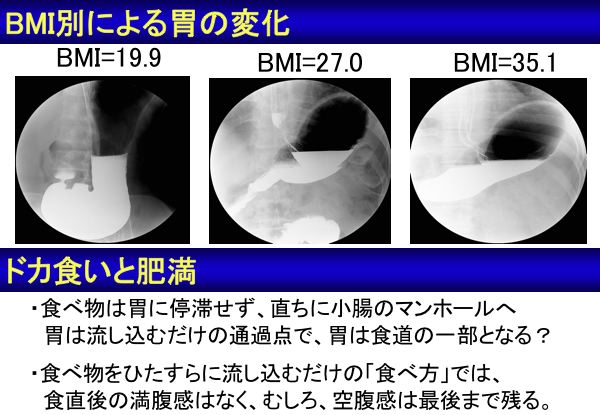 資料：BMI別による胃の変化